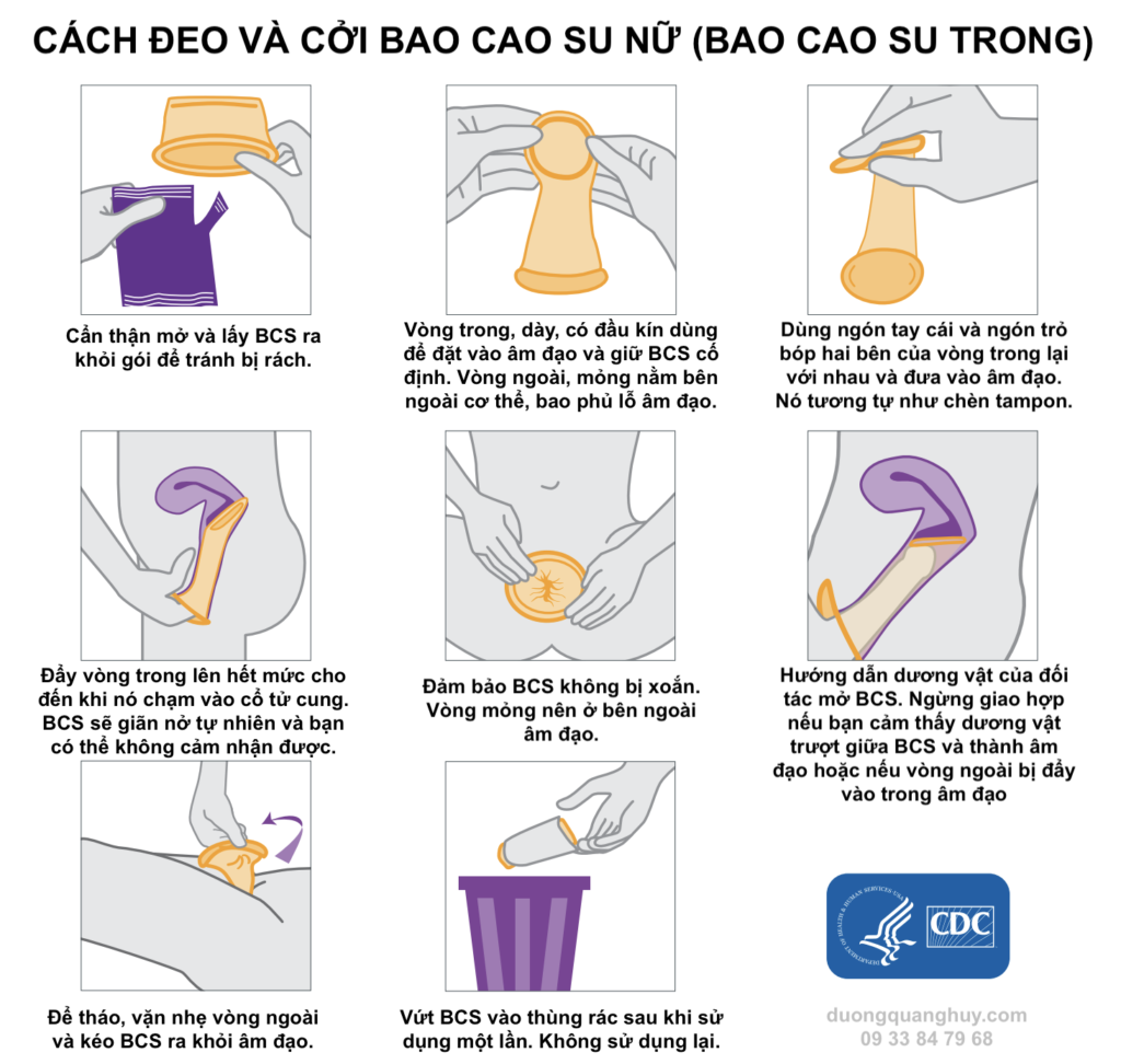 Cách sử dụng bao cao su gai bi để tăng cường khoái cảm và an toàn