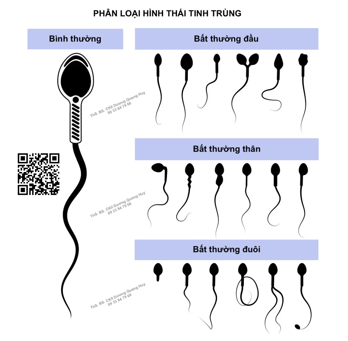 HÌNH THÁI TINH TRÙNG (HÌNH DẠNG)  CÓ ẢNH HƯỞNG ĐẾN KHẢ NĂNG SINH SẢN KHÔNG?